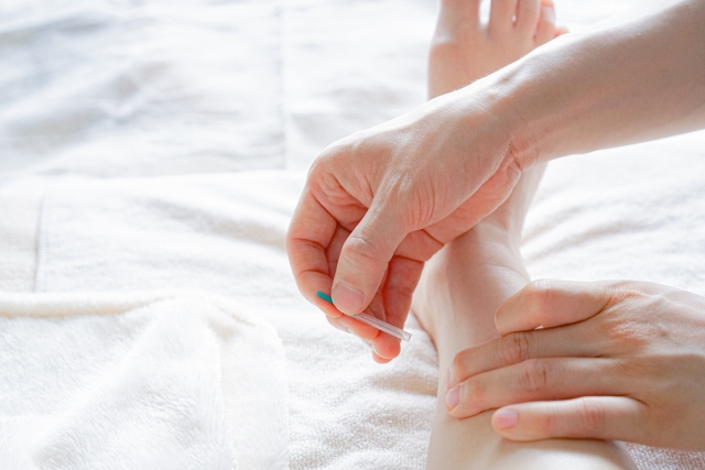 足へ針治療施術中の女性